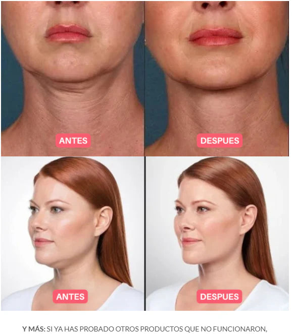 BEAUTYCARE™- Masajeador Facial Reafirmante.